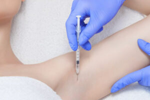 Combat Sweat Patches With Botox