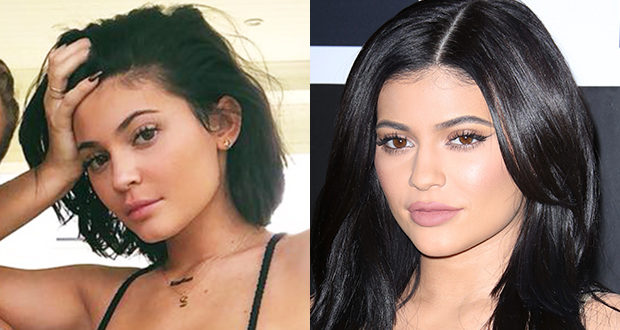 Kylie Jenner Removes Her Lip Fillers
